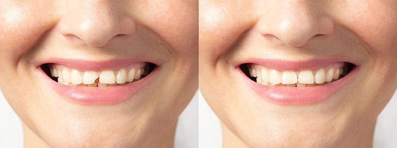 Astra Dental in-house lab technology for same day dentistry